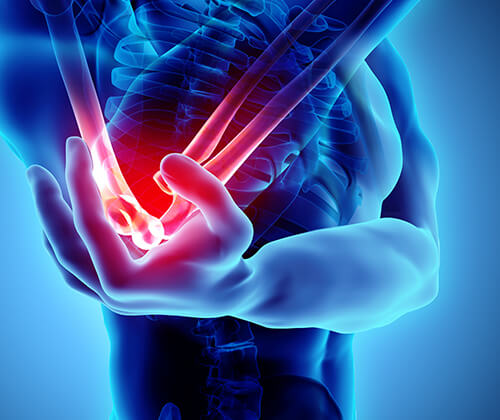 Elbow Pain Treatment in Naples, Fort Myers & Cape Coral, FL