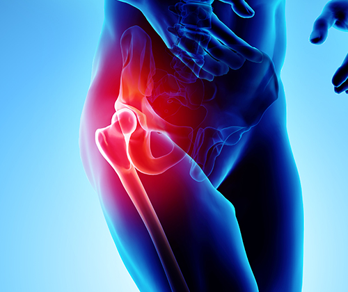 Hip Pain Treatment by Jaffe Sports Medicine