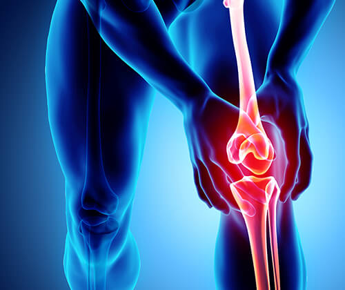 Knee Pain Treatment in Naples, Fort Myers & Cape Coral, FL