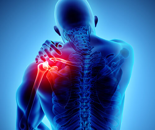 Shoulder Pain Treatment in Naples, Fort Myers & Cape Coral, FL