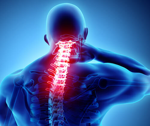 Neck Pain Treatment in Cape Coral, FL